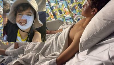 حروق مروّعة للاعب ناشئ والسبب مزحة