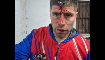 مفتاح السيارة استقر في جبين لاعب كرة قدم